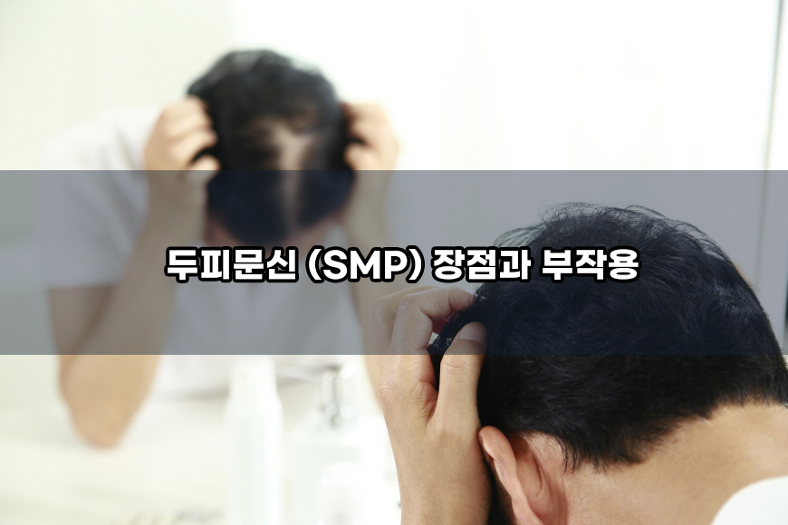 두피 문신 (smp) 장점과 부작용 가격 정보